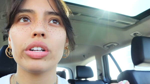 De nieuwste rage op cosmetisch gebied: getatoeëerde sproetjes