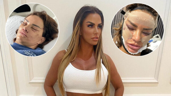 Katie 'Jordan' Price heeft zich onherkenbaar laten toetakelen door de plastisch chirurg