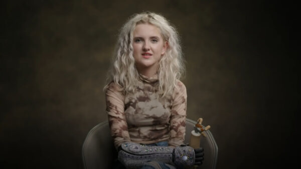 Dit is Tilly Lockey, de tiener met de bionische armen