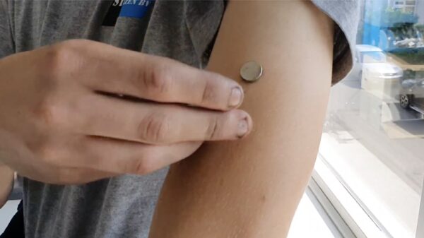 *Halp* Mijn gevaccineerde collega is spontaan magnetisch geworden!!1