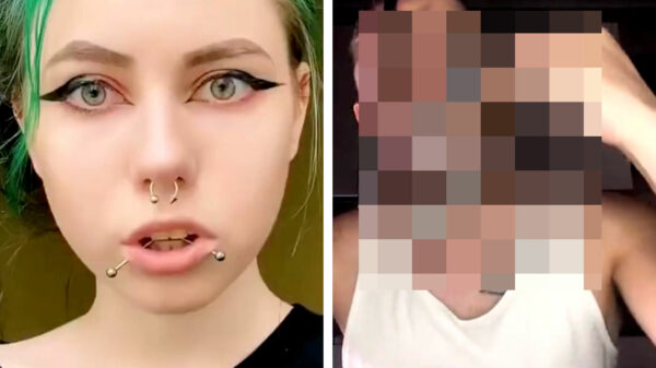 Het is altijd superhandig eten met een lading chirurgisch staal in je smoel