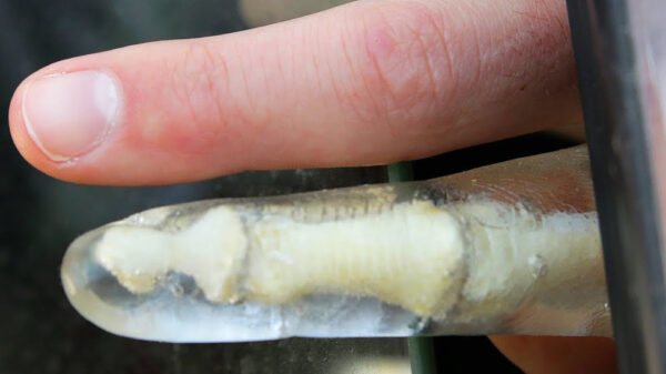 Kan een elektrisch autoraam je vinger breken?