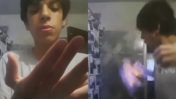 Arm ontharen met vuur levert nominatie Darwin Award op