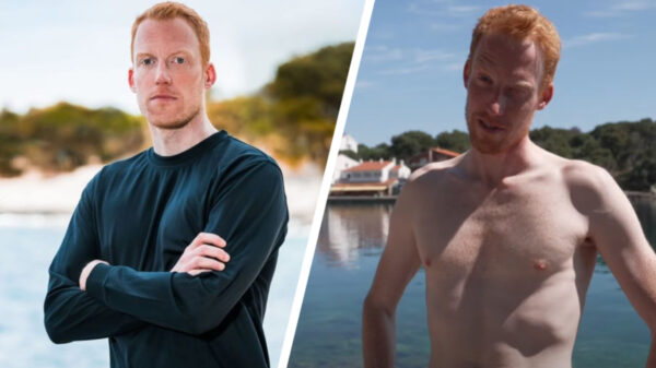 Nog eens 10 voor- en na-foto's van BN'ers die niet konden ontsnappen aan het genadeloze "Expeditie Robinson-effect"