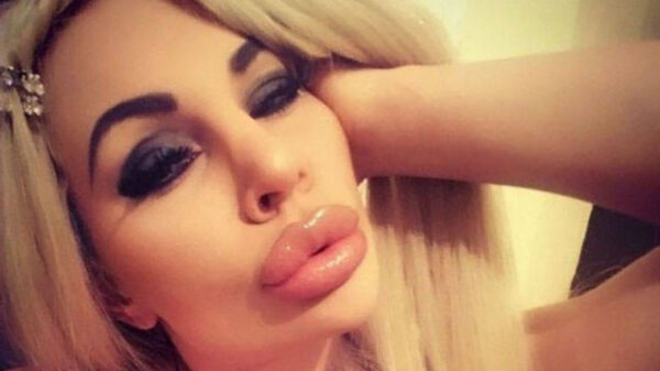 Liefhebbers van opgespoten lippen komen goed gevuld aan hun trekken