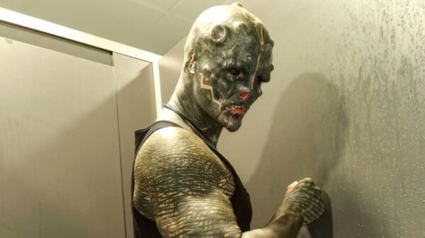 Freaky: 'The Black Alien' laat in twee vingers amputeren om op buitenaards wezen te lijken