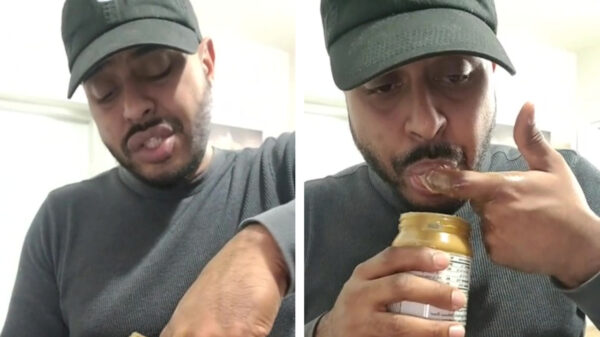 Zo ziet een extreme allergische reactie op pindakaas eruit