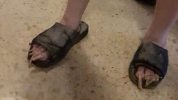 Handig voor onderweg: een complete messenset aan je tenen