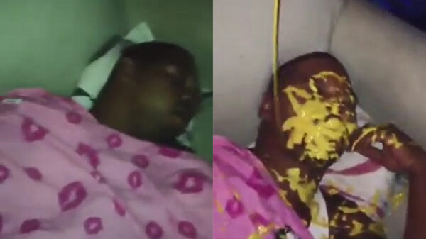 Slaapkop heeft ontzettend trage reactie als hij een mosterd-facial krijgt