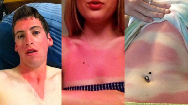 Alleen watjes smeren zichzelf in met zonnebrand deze zomer