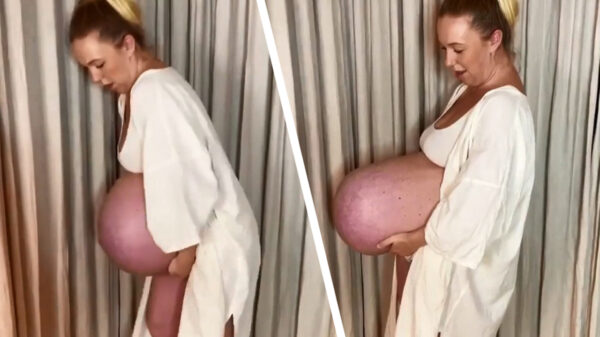 Zwanger zijn van een drieling zorgt voor een gigantische buik