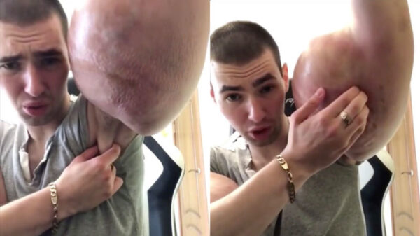 Het gaat niet zo lekker met de enorme biceps van de Russische Popeye