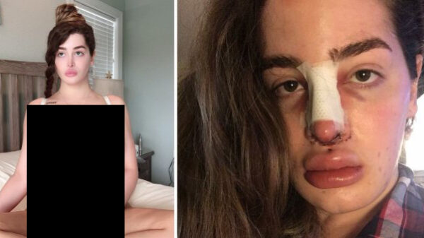 28-jarige Kristen Snider is verslaafd aan plastische chirurgie