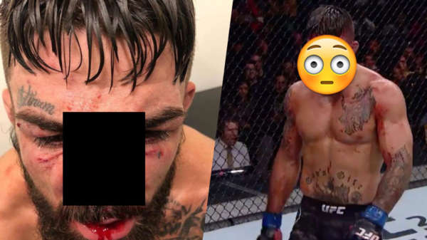 Heeft Mike Perry de meest heftige gebroken neus in de geschiedenis van de MMA?