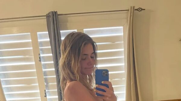 Oh jeetje: Emma Wortelboer is helemaal verbrand, heeft er iemand after-sun?