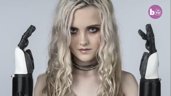 Deze 13-jarige tiener gaat met twee bionische armen door het leven