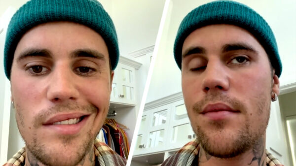 Gezicht Justin Bieber verlamd door syndroom van Ramsay-Hunt