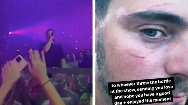 Martin Garrix krijgt tijdens concert in Las Vegas een fles tegen z'n hoofd geslingerd
