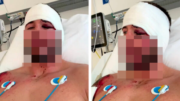 Donny Roelvink zwaargewond na ongeluk met Hummer, met klaplong en gebroken ribben in ziekenhuis