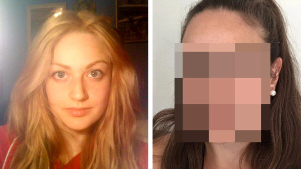 Eldina Jaganjac is klaar met het schoonheidsideaal en laat haar unibrow en snor staan