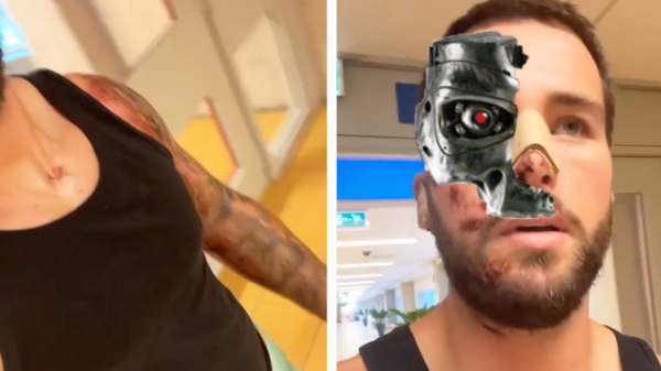 Donny "The Terminator" Roelvink is onverwoestbaar en loopt alweer rondjes door het ziekenhuis