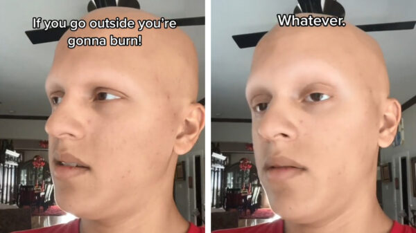 Zelfspotje van de dag: goed smeren vandaag, want het wordt snikheet