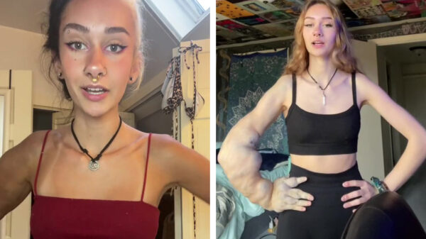 Olivia heeft één enorme arm en dat zorgt voor bizarre reacties: "amputeren!"