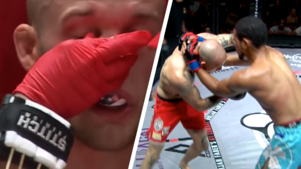 Kan iemand even checken of de neus van MMA-vechter Blake Perry gebroken is?