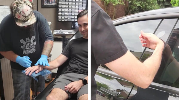 Gekkie laat chip waarmee hij zijn Tesla kan openen in zijn hand implanteren