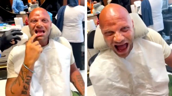 Alex Soze flink aangepakt in Turkije en heeft geen tand meer in z'n bakkes