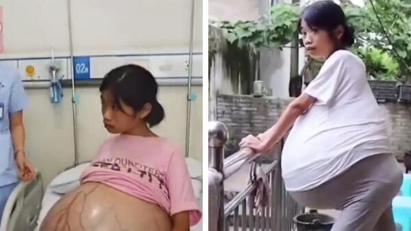 Vrouw heeft last van een opgeblazen gevoel, maar dat is ook niet vreemd!