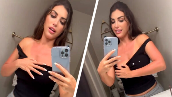 Stop de persen! Yolanthe is keihard verbrand op het strand in Los Angeles