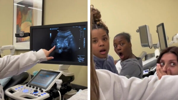 De les echografie kwam met een kleine verrassing