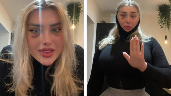 Hoofd van pas geopereerde influencer "ontploft" tijdens vliegtuigvlucht