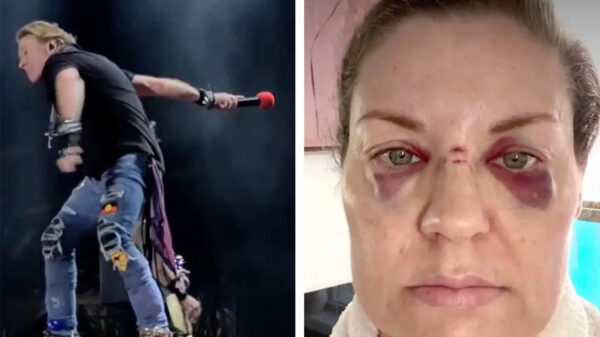 Axl Rose slingert microfoon het publiek in en raakt vrouw VOL op d'r bakkes