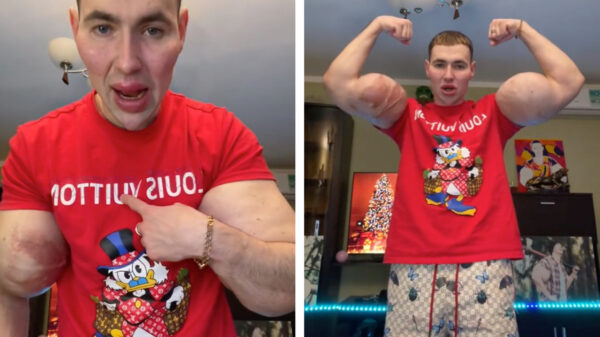 De professionele bodybuilder a.k.a. Mister Olympia is compleet 'naturel'