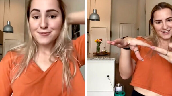 Alyssa is met het EEC-syndroom geboren waardoor ze haar middelvingers mist