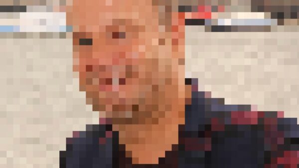 Dit zou de BN'er zijn die een hamster operatief heeft moeten laten verwijderen