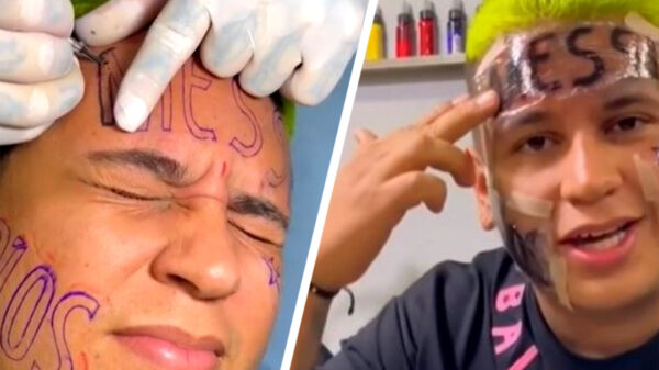 Toch wel ragrets: man die tatoeage van Messi op zijn voorhoofd zette heeft spijt