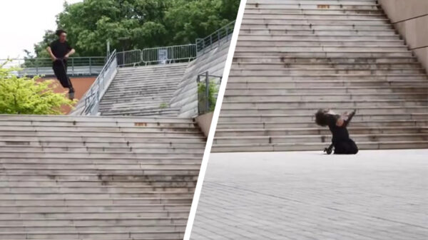 Stunten op zijn step resulteert in een bezoekje aan de kaakchirurg