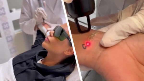 Jaimie Vaes is er helemaal klaar mee en laat haar Lil' Kleine-tattoos weglaseren