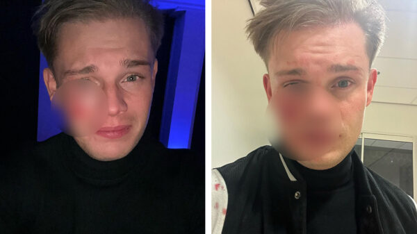 Dennis Schouten in gezicht gestoken tijdens avondje stappen in Enschede