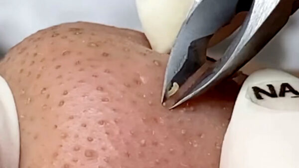 Het elimineren van mee-eters blijft een intrigerend fenomeen