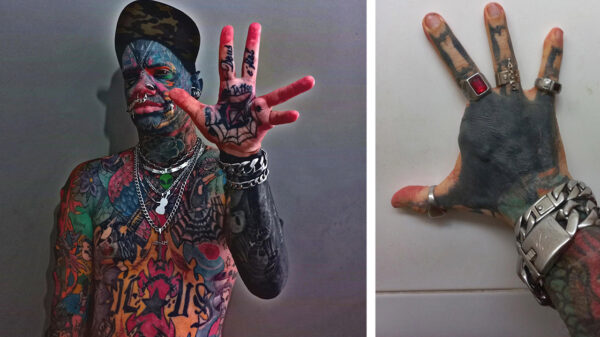 Marcelo heeft zijn wijsvinger laten verwijderen om op een buitenaardse duivel te lijken