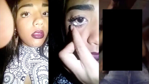 Nog even een reminder dat LSD op je oogbal plakken een erg slecht idee is