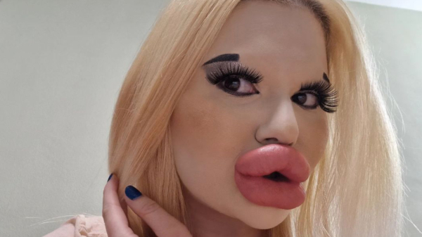 Hoe gaat het ondertussen met Andrea Ivanova, de Balkan Barbie met de krankzinnig grote lippen?