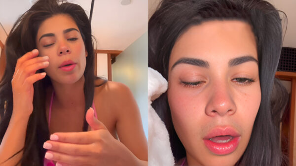 Bramty Juliette wilde haar oog druppelen maar gebruikte per ongeluk secondelijm