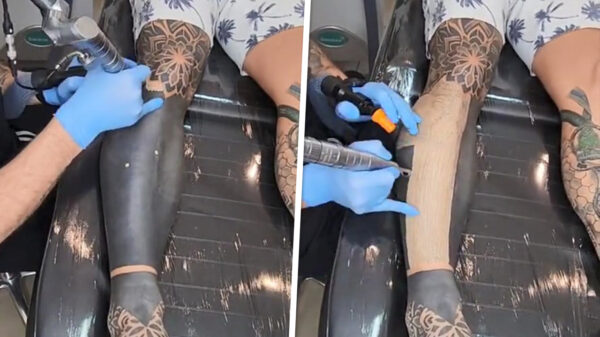 Even vredig toekijken hoe een tattoo wordt verwijderd