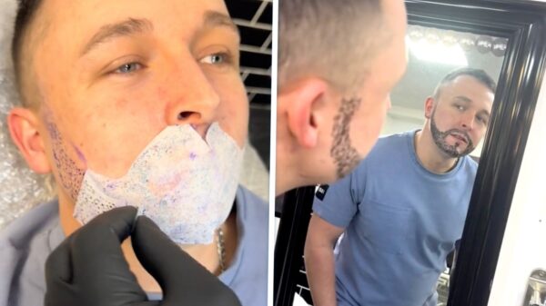 Man laat baard tatoeëren maar het eindresultaat is om te janken