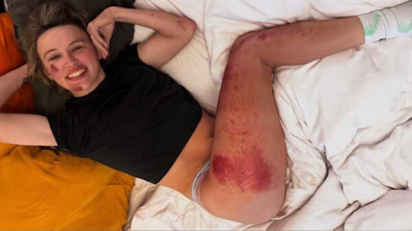 Kasia Niewiadoma maakt harde crash in Strade Bianche en deelt de schade